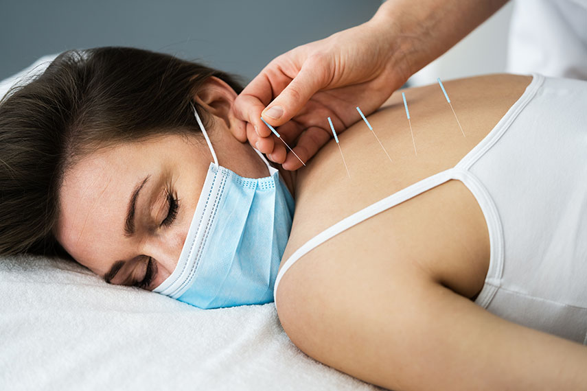 Dry-Needling